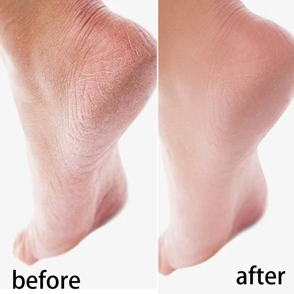 Silicone Moisturizing Mask Socks